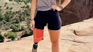 The Beautiful Woman Has An Amputated Leg And Walks On One Leg With One Crutch #Amputee