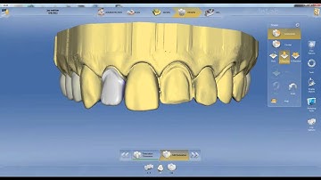 Inlab 4.0 Introduction