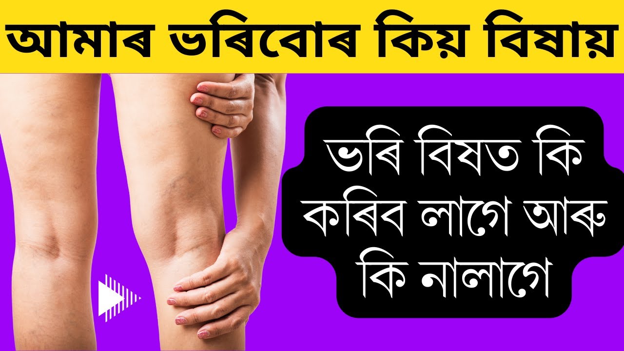 ভৰি বিষ ভাল পাবলৈ  কি কৰিব লাগে || Leg Pain, Causes and it's Treatment || Ponkhi Sharma