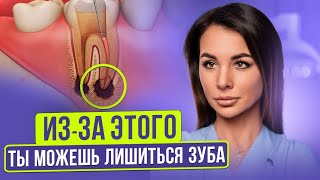 Что такое периодонтит (КИСТА зуба) и почему он появляется ? | Чем ОПАСНА киста зуба ?