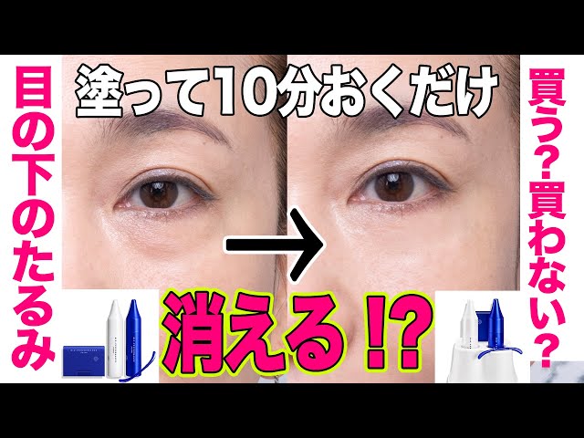 目の下のたるみ】新発想でたるみをなかったことにするアイテム