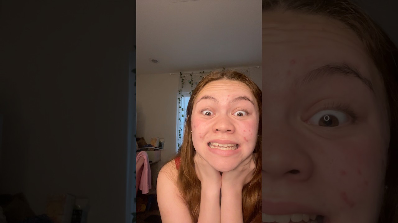 YGS лучше бы ничего не говорили о моей внешности, я только что проснулся 