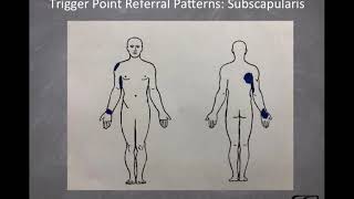 SturdyShoulders.com: Subscapularis 101