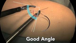 suturing video for AAGL screenshot 1