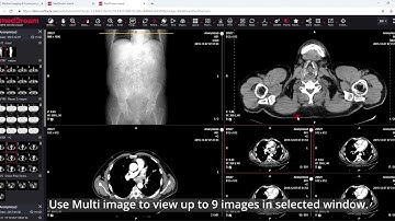 MedDream DICOM Viewer: the multi-image view