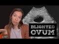 What is a blighted ovum anembryonic pregnancy explained by a genetic counselor