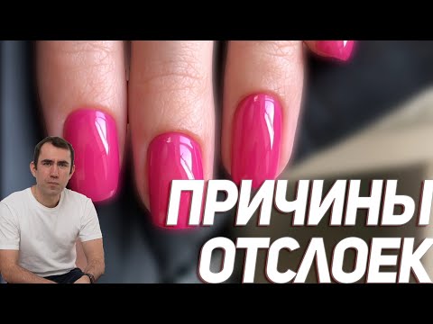 причины сколов и отслоек покрытия маникюра