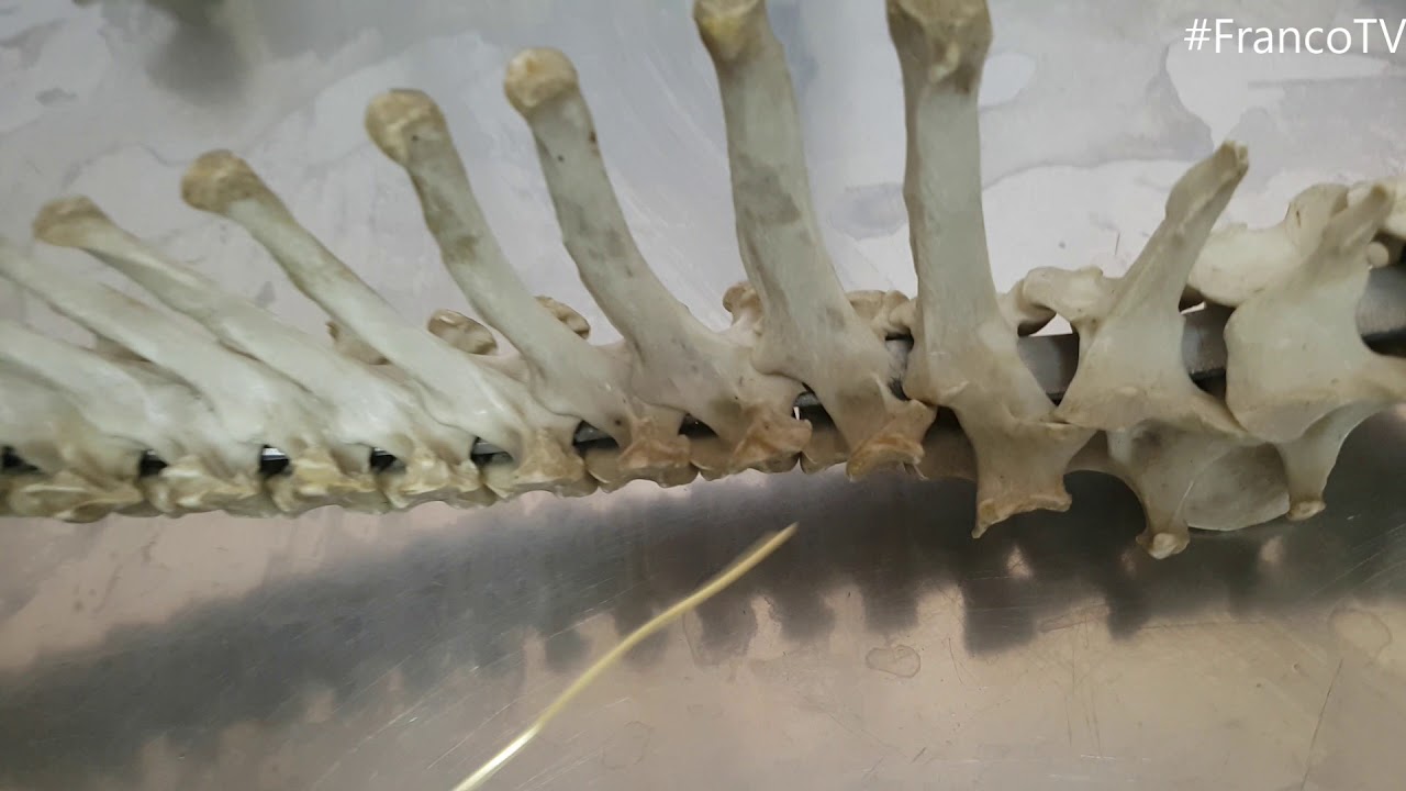 Anatomía - Columna vertebral, vertebra 