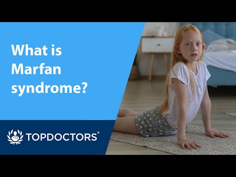 سندرم مارفان چیست