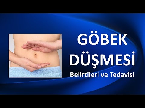 GÖBEK DÜŞMESİ Belirtileri ve Tedavisi