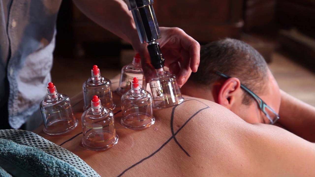 Comment Soulager La Grippe Avec Des Ventouses Chinoises Video 5 Youtube