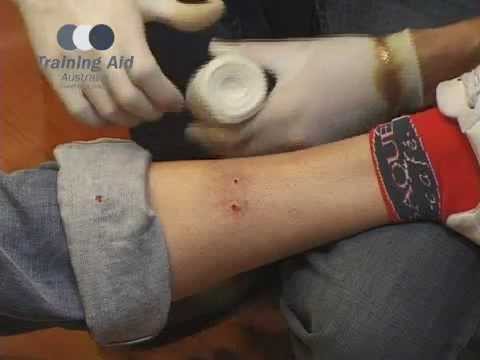 Wideo: Co to jest bandaż unieruchamiający ucisk?