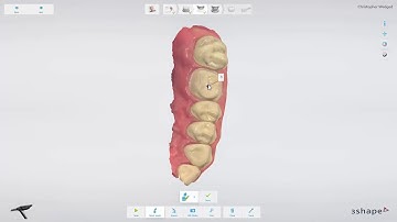 3Shape TRIOS Design Studio - Overview Japanese