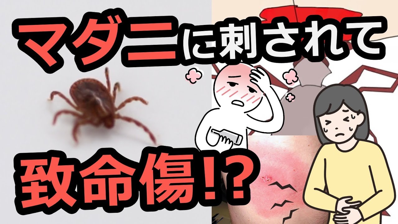 マダニに刺されて感染る感染症は？刺された時の対処法は？ - YouTube