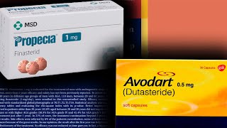 How To Switch From Finasteride To Dutasteride According To Literature
