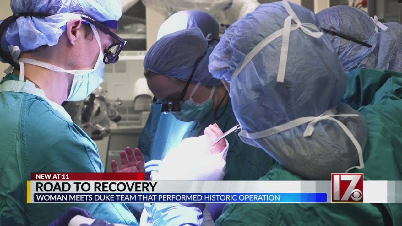 Woman who received NC's first bilateral hand transplant meets Duke doctors who made it possible