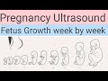 Early Pregnancy Ultrasound!Fetus Development week by week!Obstetric scan#ultrasoundmadeeasy86#baby