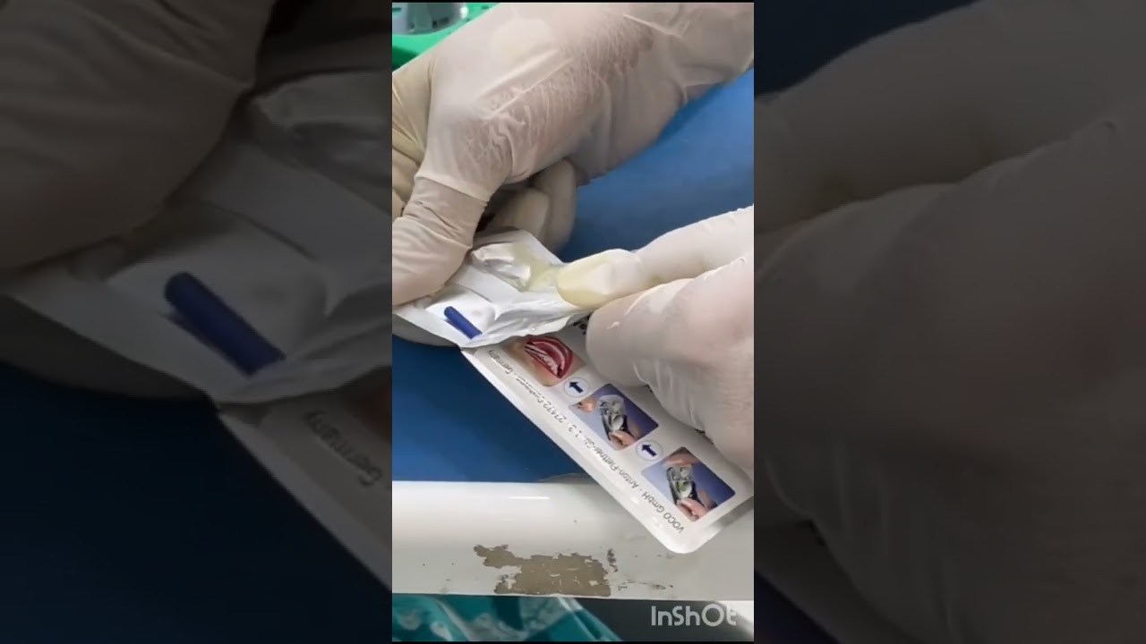 VOCO Pro Fluoride Varnish 