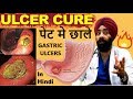 Rx Digestion #6 (Hindi) पेट मे अल्सर (छाले) Peptic, Gastric & Duodenal Ulcers | by Dr.Education