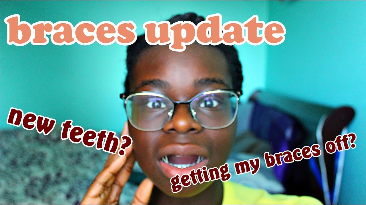 My last braces update? YouTube