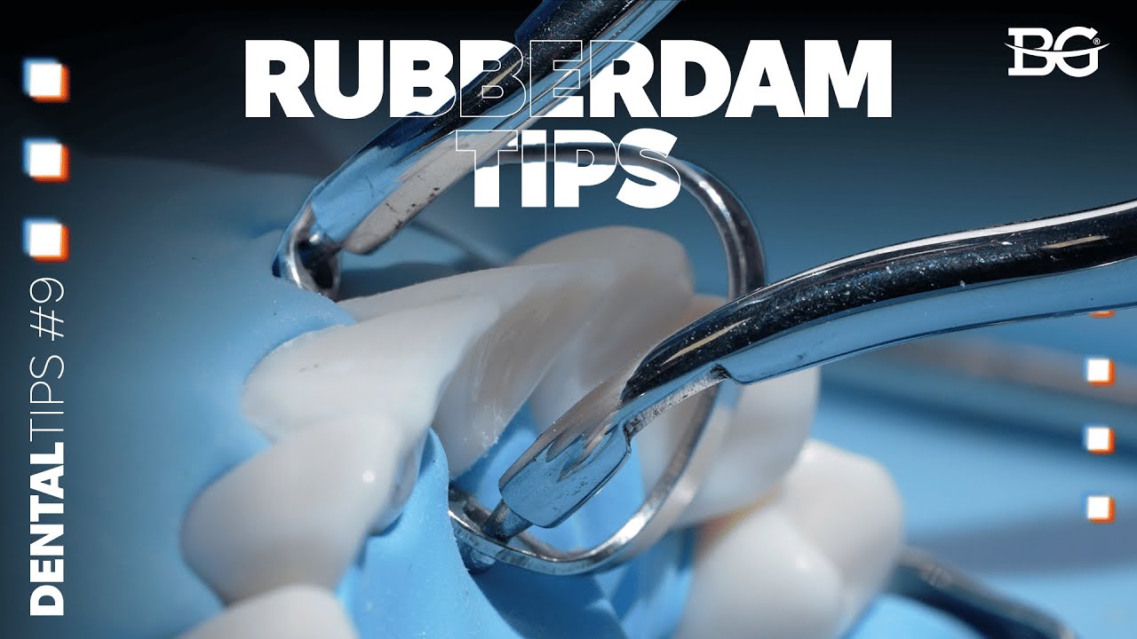 Brinker clamp stability hacks: simple tweaks for instant results