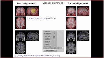 SPM12 (Kyiv 2015): part 2 - reorientation 2/3