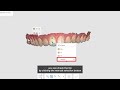 Smart shade guide tutorial on medit  evident digital  dental cad design