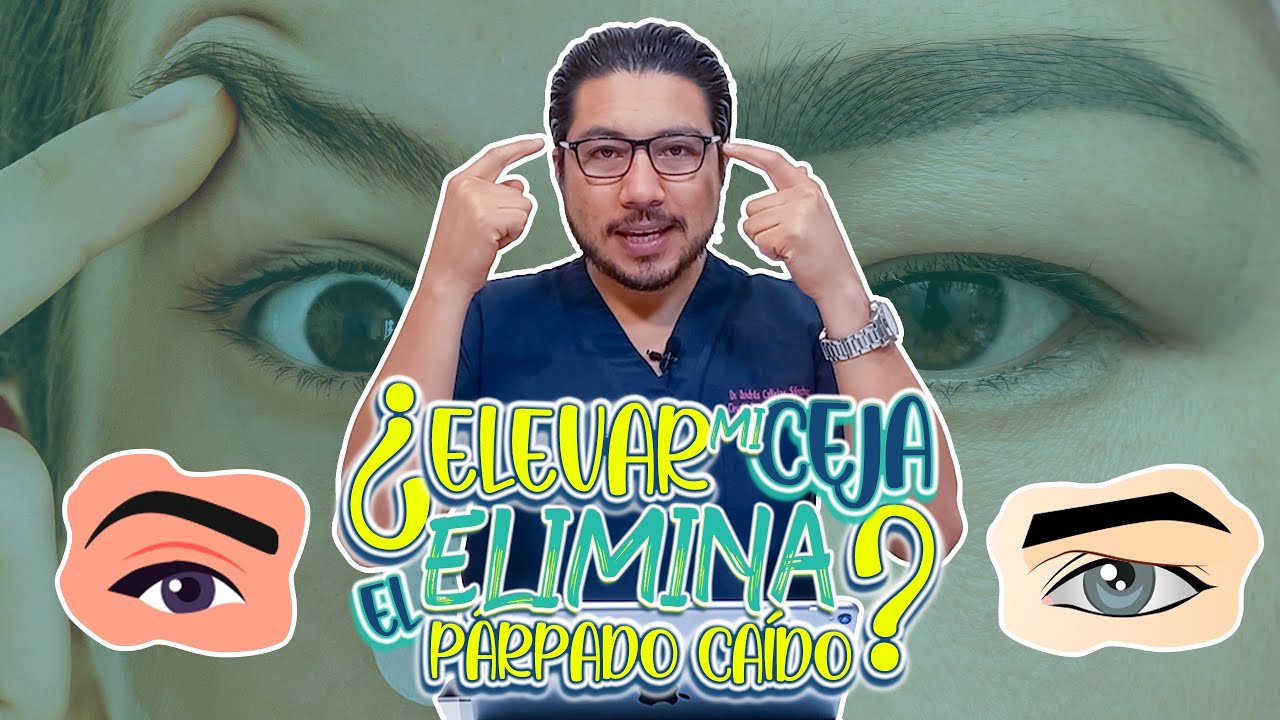 Blefaroplastía Vs Pexia - Diferencias y todo lo que tienes que saber - Dr. Andrés Callejas