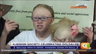 Let Us Celebrate Albinism- Dalyn Kakuya Tanga