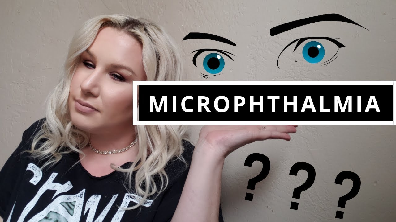 Microphthalmia - YouTube