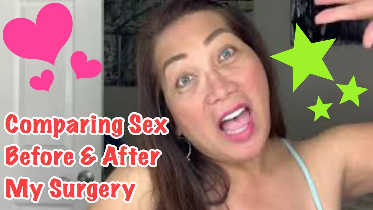 Sex Before And After My Sex Reassignment Surgery Youtube