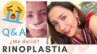 RINOPLASTIA RESULTADOS 1 año Respondiendo Preguntas Frecuentes