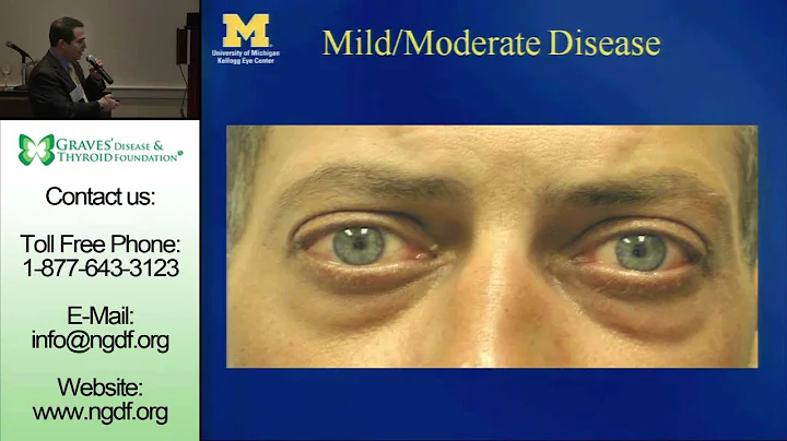 Dr. Alon Kahana - "My Approach to Evaluating Patie...