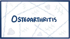 Osteoarthritis - causes, symptoms, diagnosis, treatment & pathology