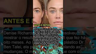 ANTES E DEPOIS #shorts