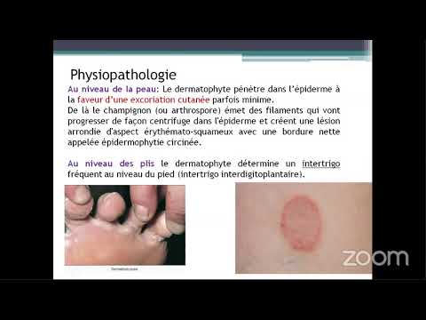 🔴Parasitologie: Dermatophytes et Dermatophyties