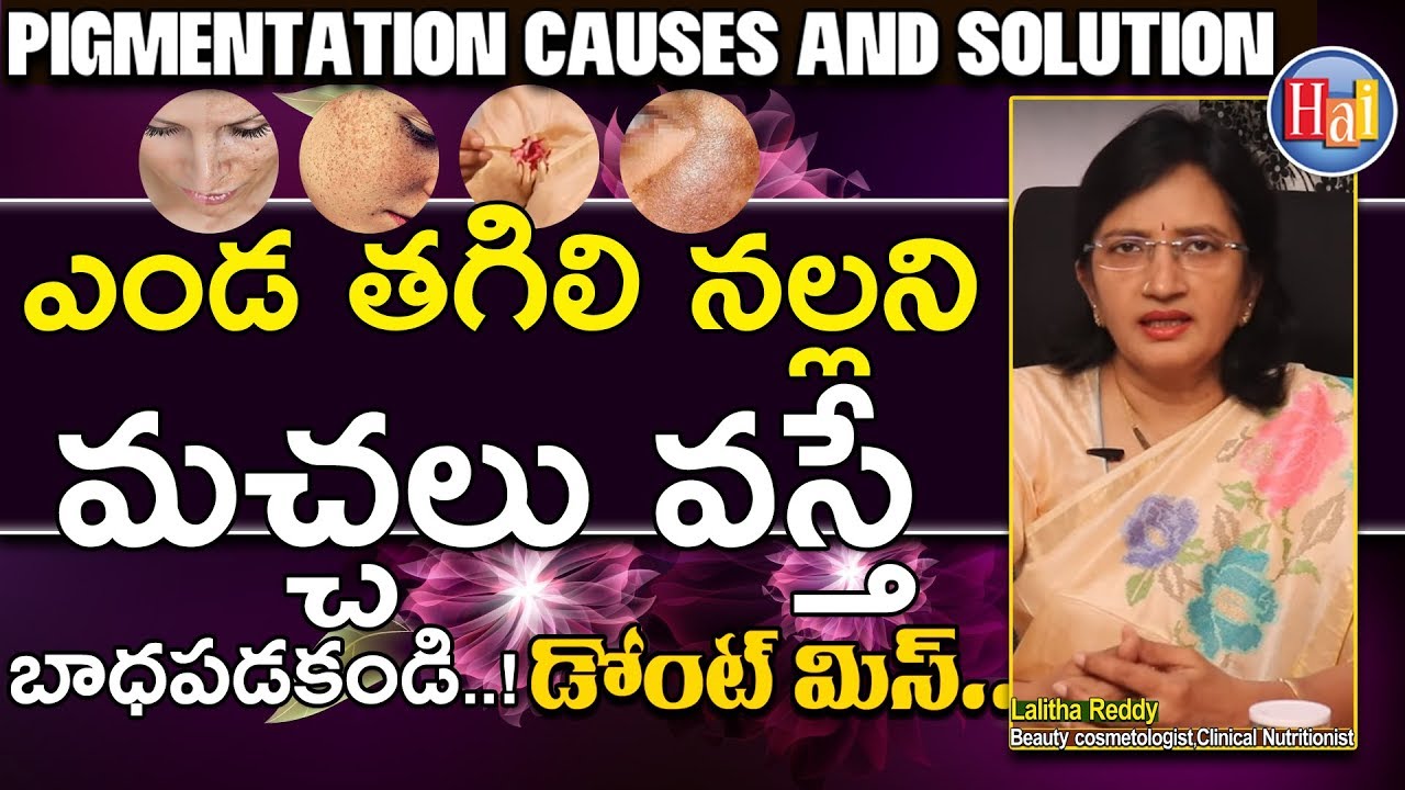 Pigmentation Causes And Solution to Reduce it Naturally l Lalitha Reddy l Hai TV