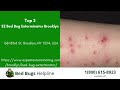 Top 3 Bed Bug Removal in Burbank