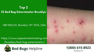 Top 3 Bed Bug Removal in Burbank