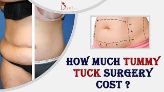 How Much Tummy Tuck Surgery Cost | Plastic Surgery in India | Cost of Tummy Tuck Surgery