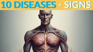 Signs & Symptoms of 10 DISEASES You Need to Know