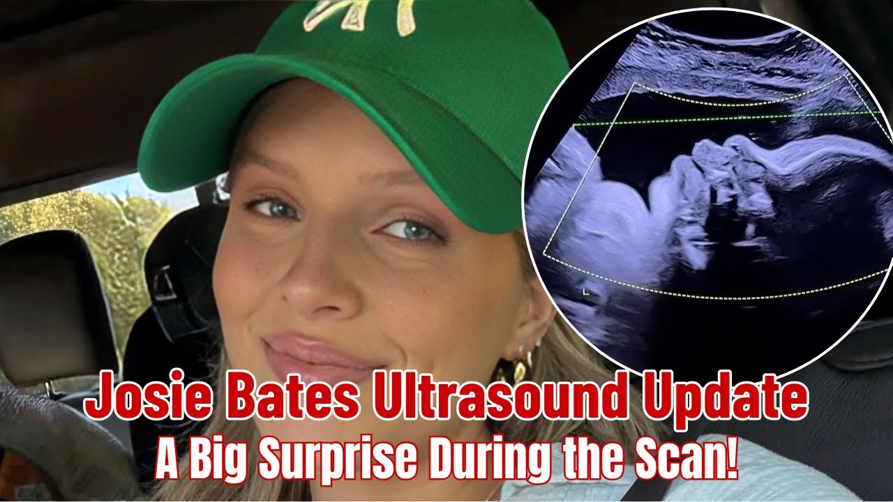 Джози Бейтс в шоке от неожиданных результатов УЗИ | Bringing Up Bates