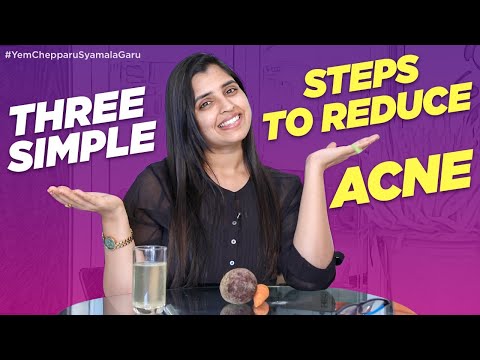 Acne కి చక్కటి సొల్యూషన్ | Skin Care Tips by #AnchorSyamala | Yem Chepparu Syamala Garu