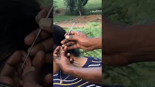 Extreme Hard Stone Removal WATCH FULL VIDEO #asmr #short #shortsviral #shortsfeed #earwaxremoval