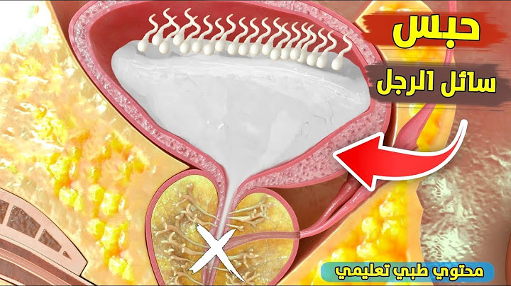 شاهد ما يحدث عند حبس سائل الرجل | محتوي طبي تثقيفي