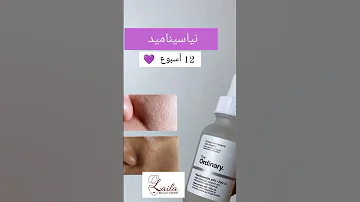 المدة الازمة حتى تبان نتيجة سيرومات اورديناري بشرة تصبغات حبوب الوجه اورديناري 