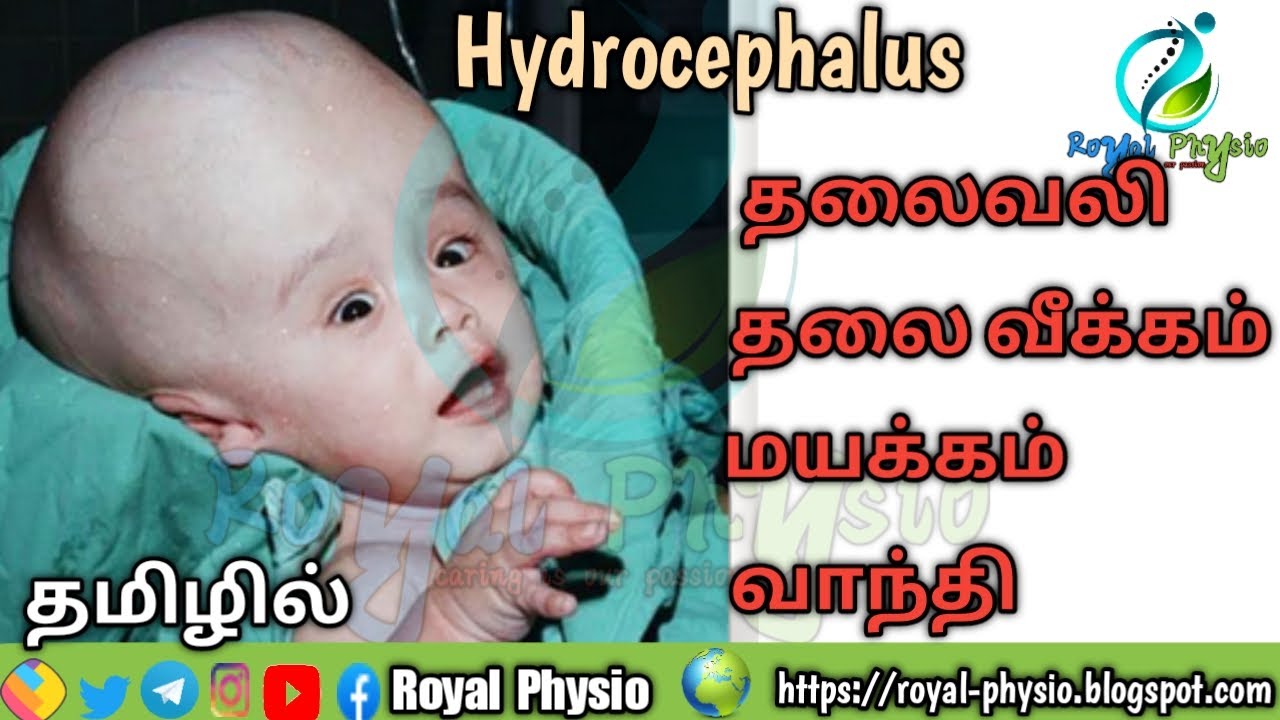 how-to-recover-in-hydrocephalus-what-is-hydrocephalus-in-tamil