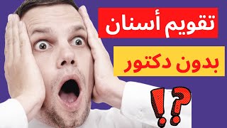 تقويم الاسنان بدون طبيب