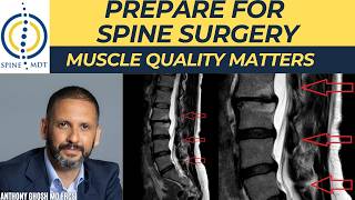 How to Improve Your Spine Surgery Outcome Before the Operation