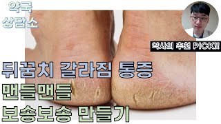 30. 약사가 추천하는 발 뒤꿈치 갈라짐, 통증 특효약!